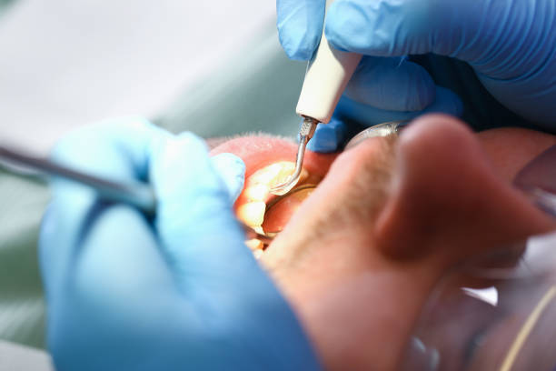 Best Broken Tooth Emergency  in Kenwood, OH